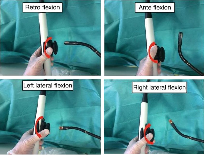 Quatre photographies de la pointe de la sonde d'ETO fléchie dans les quatre directions possibles selon la molette actionnée.