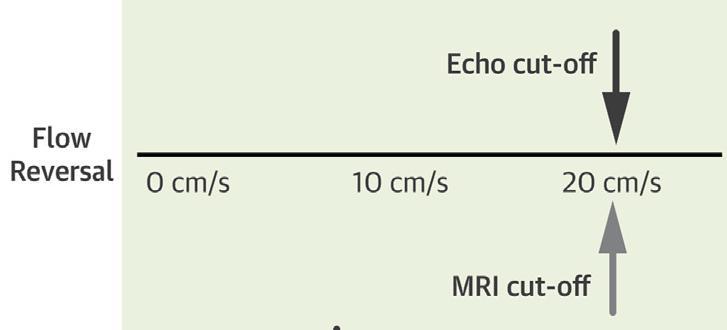 Schéma comparant les seuils de détection du flux de régurgitation entre échographie et IRM cardiaque.
