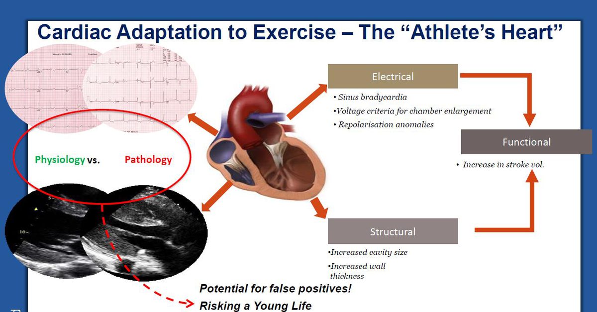 Schéma conceptuel opposant les adaptations électriques, fonctionnelles et structurelles du cœur d'athlète à leur pendant pathologique, avec tracés ECG et images échographiques.