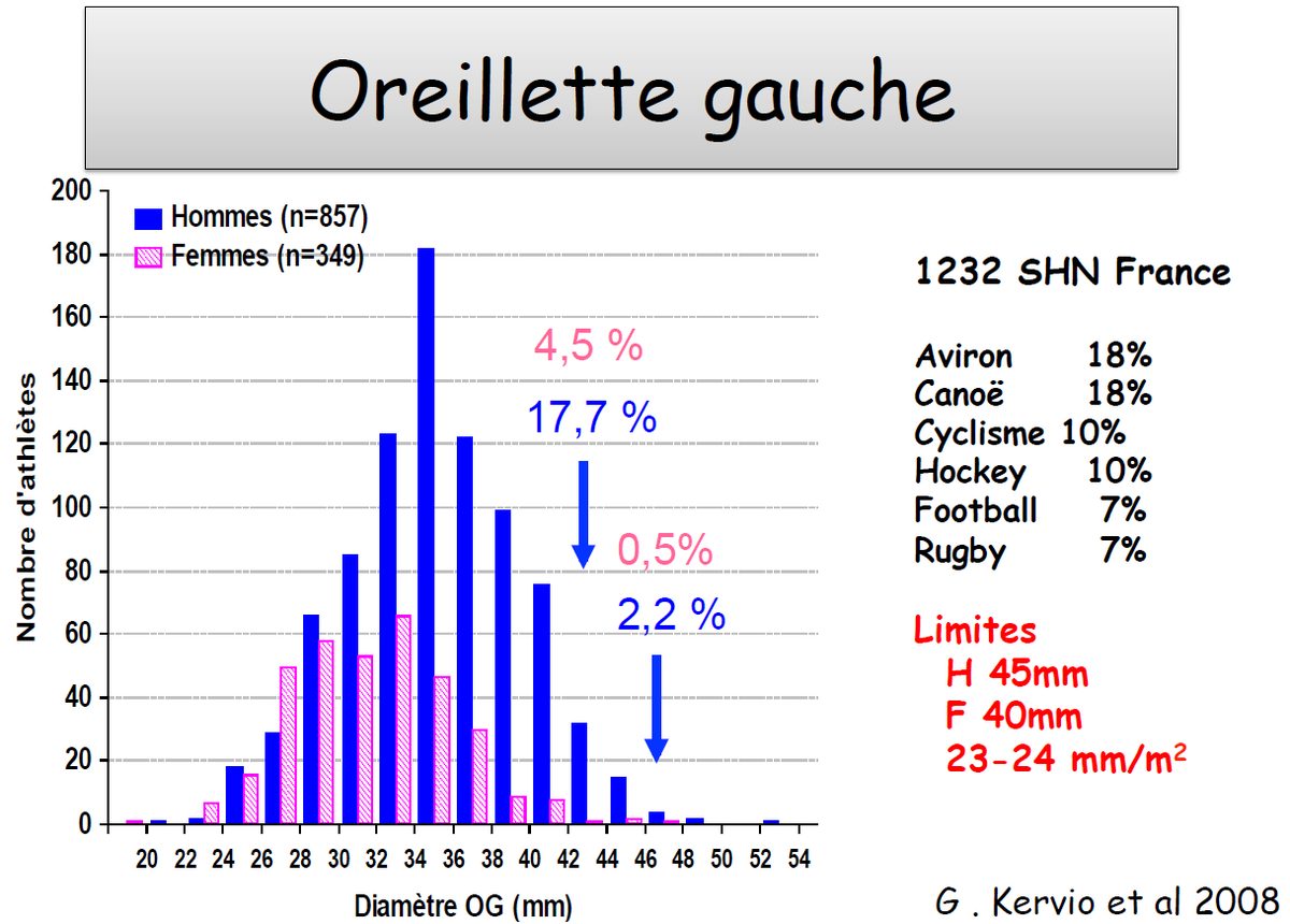 Deux histogrammes de la distribution du diamètre de l'oreillette gauche chez des sportifs de haut niveau, hommes et femmes, avec un tableau des disciplines les plus concernées.