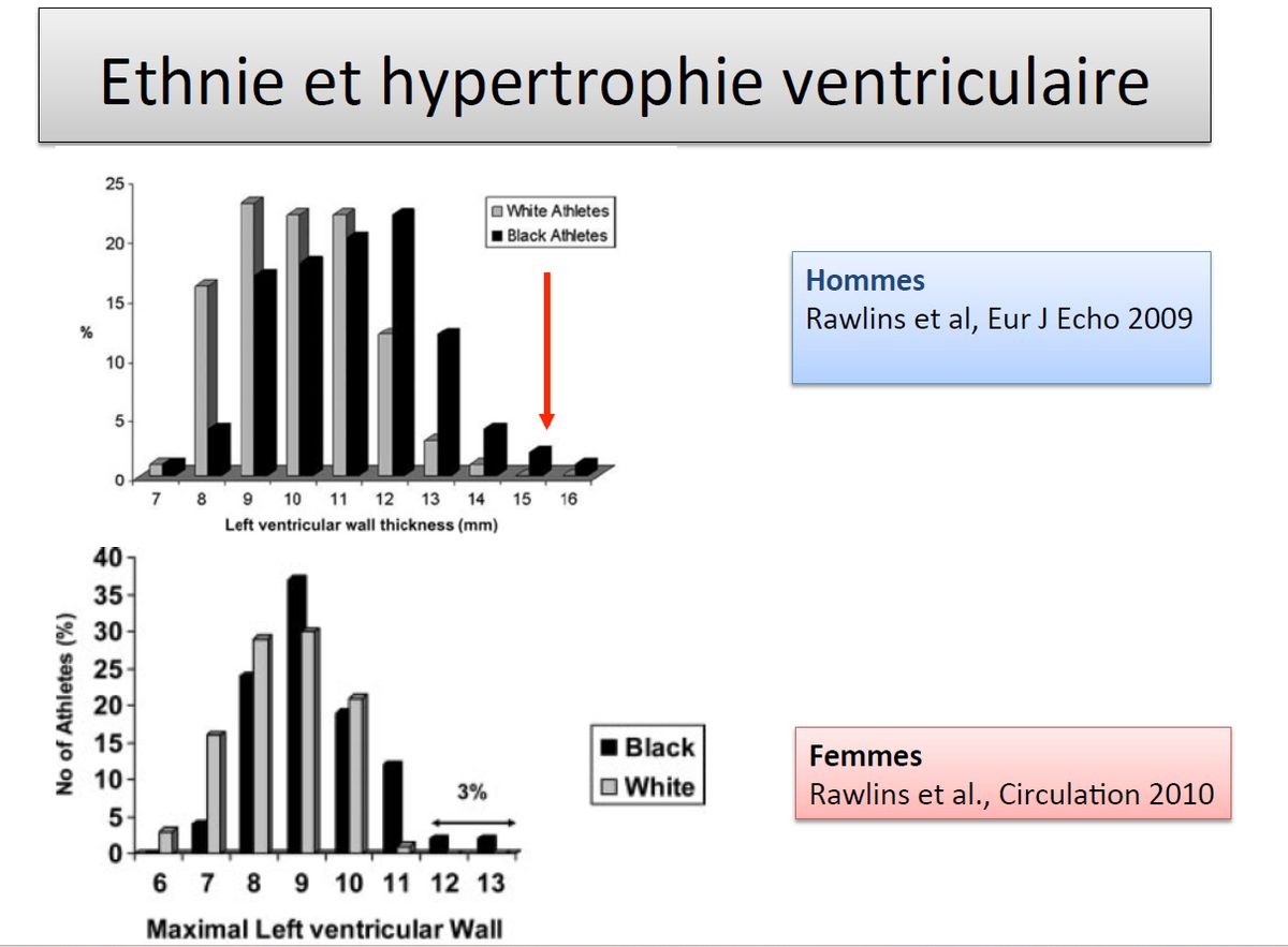 Deux histogrammes comparant la distribution de l'épaisseur pariétale ventriculaire gauche entre athlètes blancs et noirs, chez les hommes et chez les femmes.
