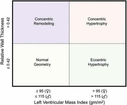Quadrant classant le remodelage ventriculaire gauche selon l'épaisseur relative de la paroi et la masse ventriculaire indexée.