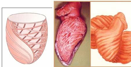 Schéma et pièces anatomiques montrant l'architecture hélicoïdale des fibres myocardiques du ventricule gauche.