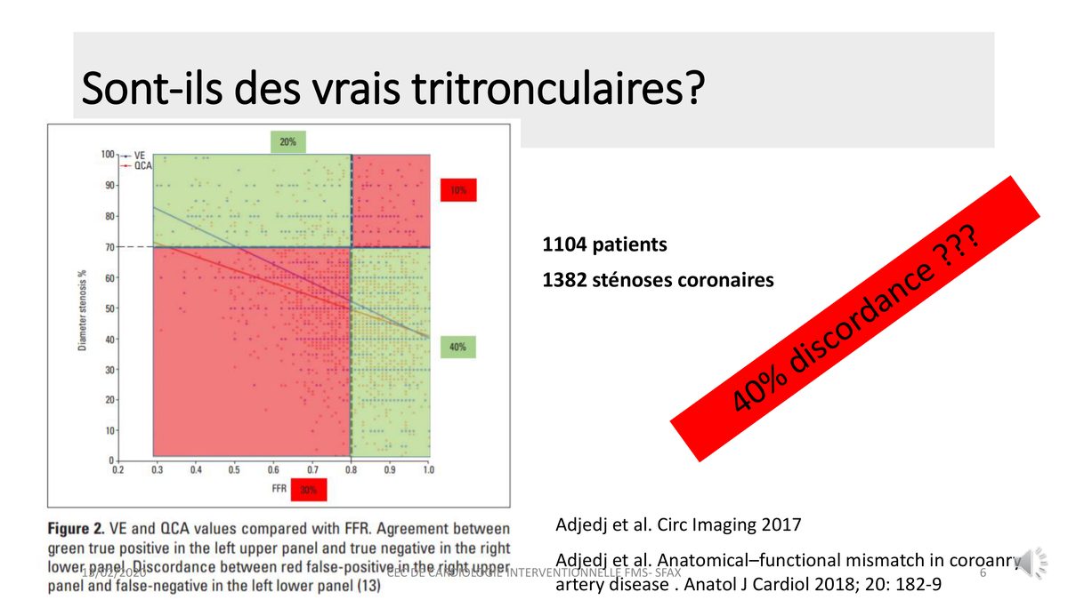 Nuage de points comparant le pourcentage de sténose angiographique à la réserve de débit fractionnaire, avec quatre quadrants d'accord et de désaccord.