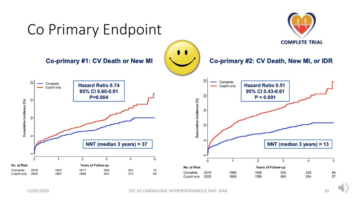 Deux courbes d'incidence cumulée comparant revascularisation complète et traitement de la seule artère coupable après un infarctus.