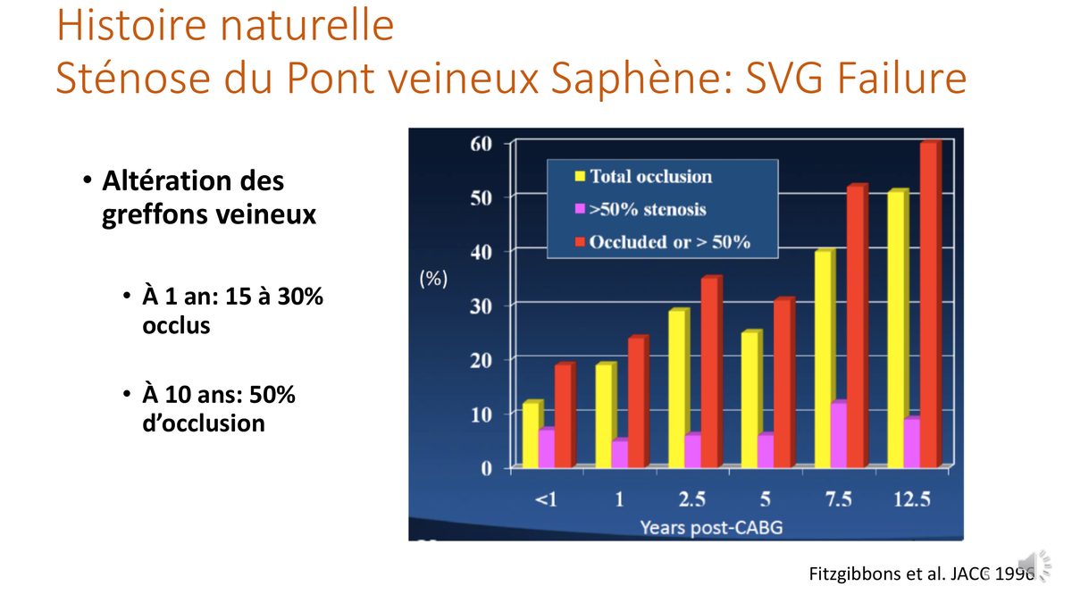 Diagramme en barres de la proportion de greffons veineux occlus ou sténosés à différentes échéances après le pontage.