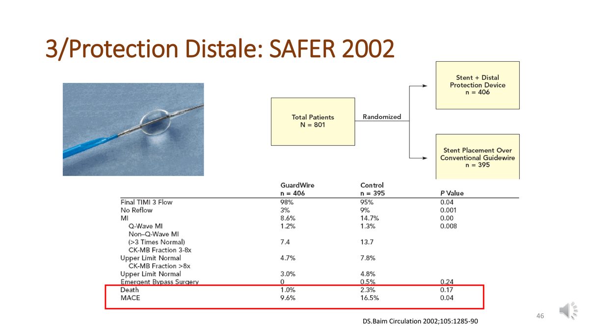 Dispositif de protection distale, plan de l'essai randomisé et tableau de ses résultats à trente jours.