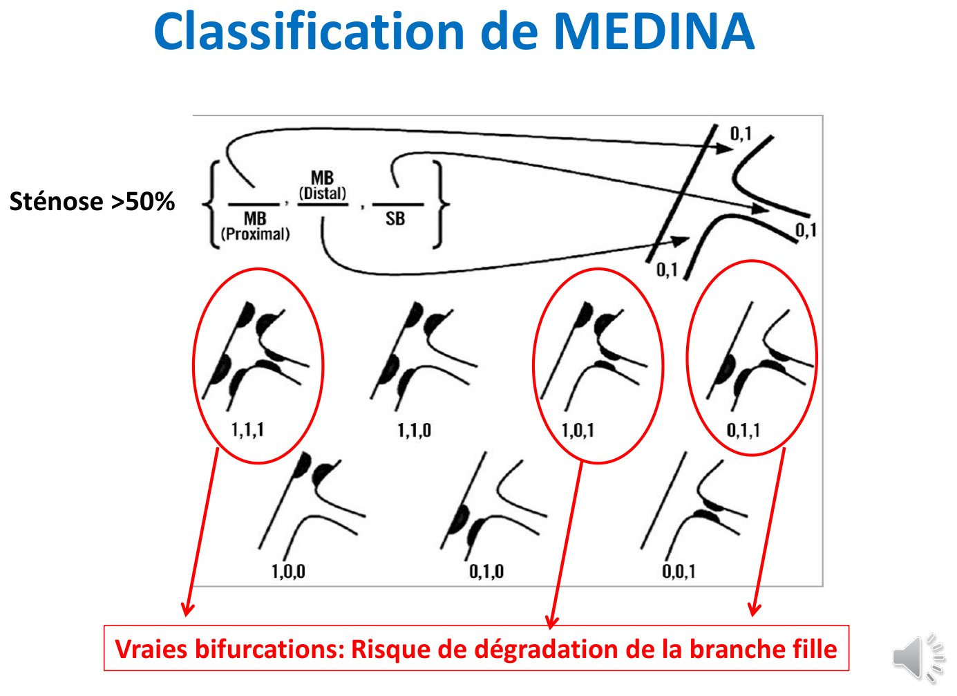 Planche de schémas des huit combinaisons de Medina, de 1,1,1 à 0,0,1, avec la légende des trois segments en haut et trois configurations entourées en rouge — 1,1,1, 1,0,1 et 0,1,1 — désignées comme les vraies bifurcations.