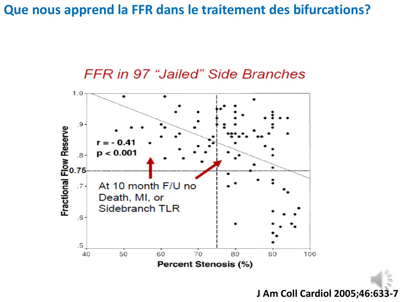 Nuage de points portant le pourcentage de sténose en abscisse et la réserve de débit fractionnaire en ordonnée, avec la droite de régression descendante, le seuil horizontal de 0,75 et la verticale à 75 % de sténose délimitant quatre quadrants dont l'un, largement peuplé, réunit les sténoses serrées à mesure normale.