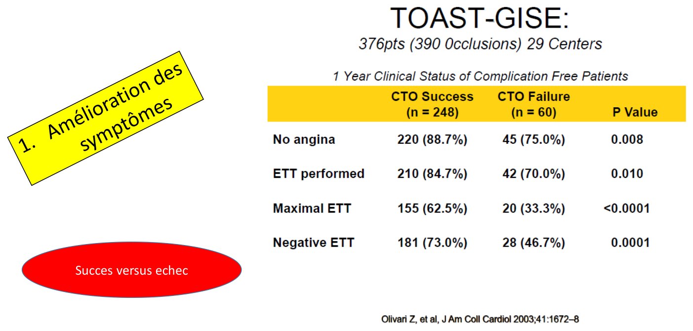 Tableau comparant, à un an, deux cent quarante-huit patients dont la désobstruction a réussi à soixante chez qui elle a échoué, sur quatre lignes — absence d'angor, épreuve d'effort réalisée, épreuve maximale, épreuve négative — chacune assortie de son effectif, de son pourcentage et de sa valeur de p.