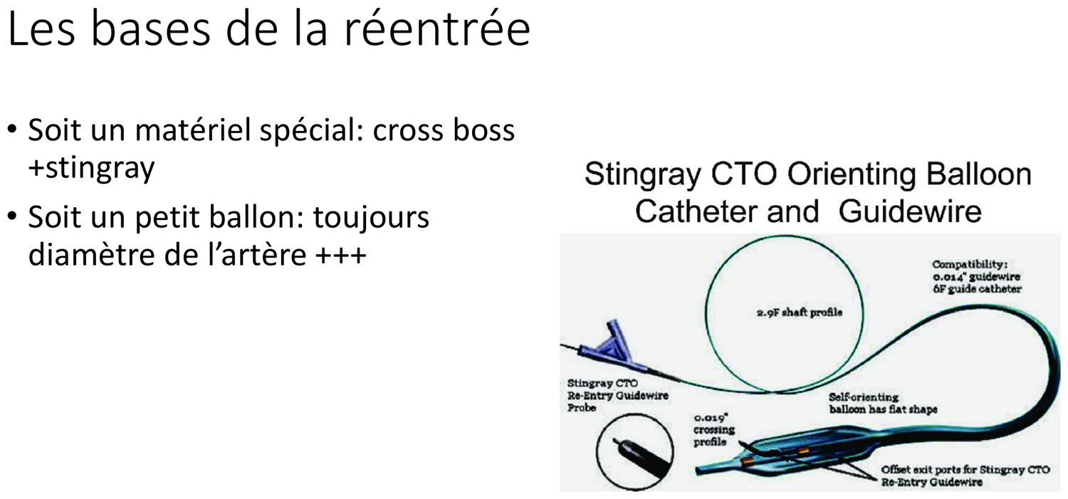 Planche intitulée « Les bases de la réentrée », opposant deux moyens. Le premier est un matériel dédié, illustré par le schéma d'un ballon plat orienteur monté sur un cathéter, muni d'orifices de sortie latéraux décalés par lesquels un guide de rentrée est dirigé vers la vraie lumière ; le schéma détaille le profil de franchissement et l'auto-orientation du ballon contre la paroi. Le second est un simple ballon, avec la mention que son diamètre doit toujours être celui de l'artère.
