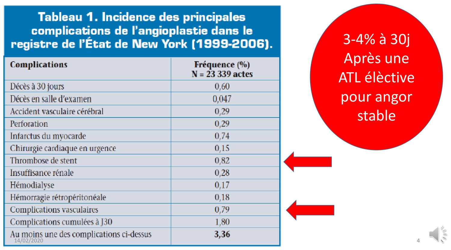 Tableau à deux colonnes issu du registre de l'État de New York portant sur les années 1999 à 2006. Il énumère, avec leur fréquence en pourcentage, les décès à trente jours, les décès en salle d'examen, l'accident vasculaire cérébral, la perforation, l'infarctus du myocarde, la chirurgie cardiaque en urgence, la thrombose d'endoprothèse, l'insuffisance rénale, l'hémodialyse, l'hémorragie rétropéritonéale et les complications vasculaires. Deux flèches rouges désignent les lignes de cumul, dont la dernière indique qu'au moins une de ces complications survient dans 3,36 % des actes.