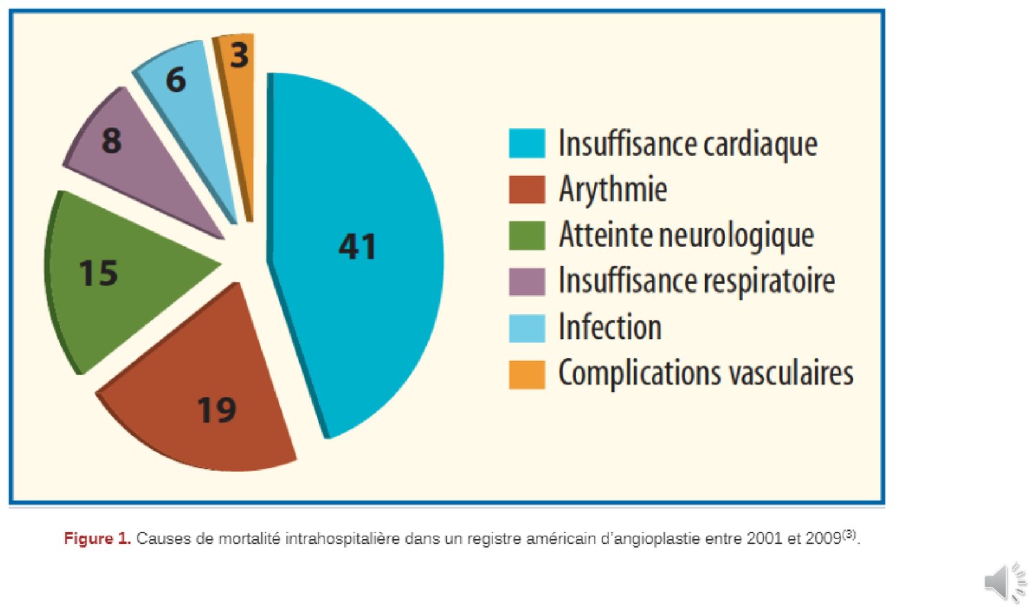 Diagramme circulaire des causes de mortalité intrahospitalière dans un registre américain d'angioplastie couvrant les années 2001 à 2009. Le secteur le plus large, représentant plus de quatre décès sur dix, correspond à l'insuffisance cardiaque. Viennent ensuite, par ordre décroissant, les arythmies, les atteintes neurologiques, l'insuffisance respiratoire, les infections et les complications vasculaires. Aucune des causes représentées ne correspond à un accident technique survenu en salle.