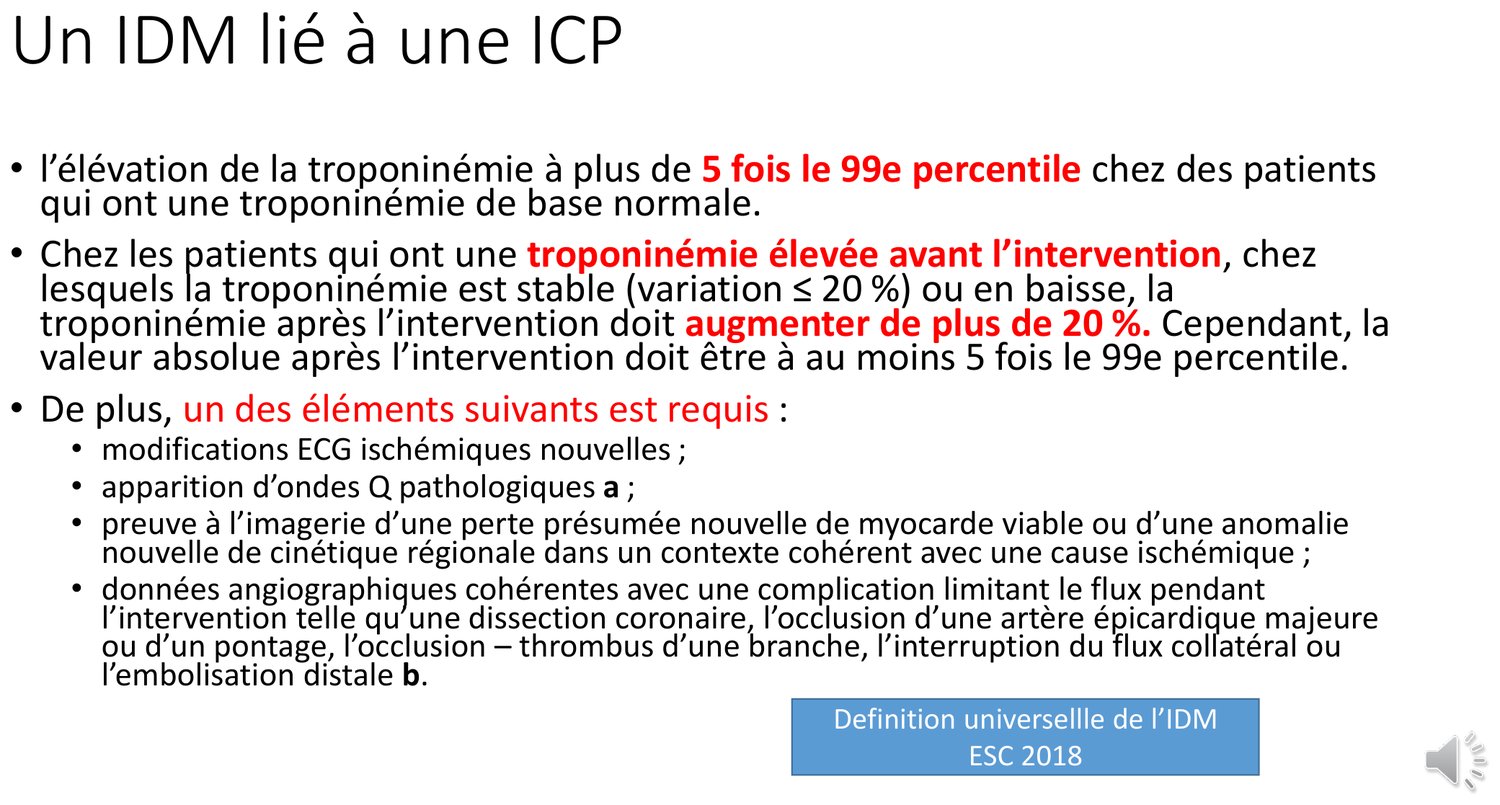 Planche détaillant la définition retenue par la quatrième définition universelle de l'infarctus. Elle exige une élévation de la troponine à plus de cinq fois le 99ᵉ percentile chez un patient dont la valeur de base était normale ; chez un patient dont la troponine était déjà élevée mais stable ou en baisse, une augmentation de plus de 20 % avec une valeur absolue atteignant cinq fois le 99ᵉ percentile. À cela doit s'ajouter au moins un élément parmi des modifications électriques ischémiques nouvelles, des ondes Q pathologiques, une preuve à l'imagerie, ou des données angiographiques de complication limitant le flux.