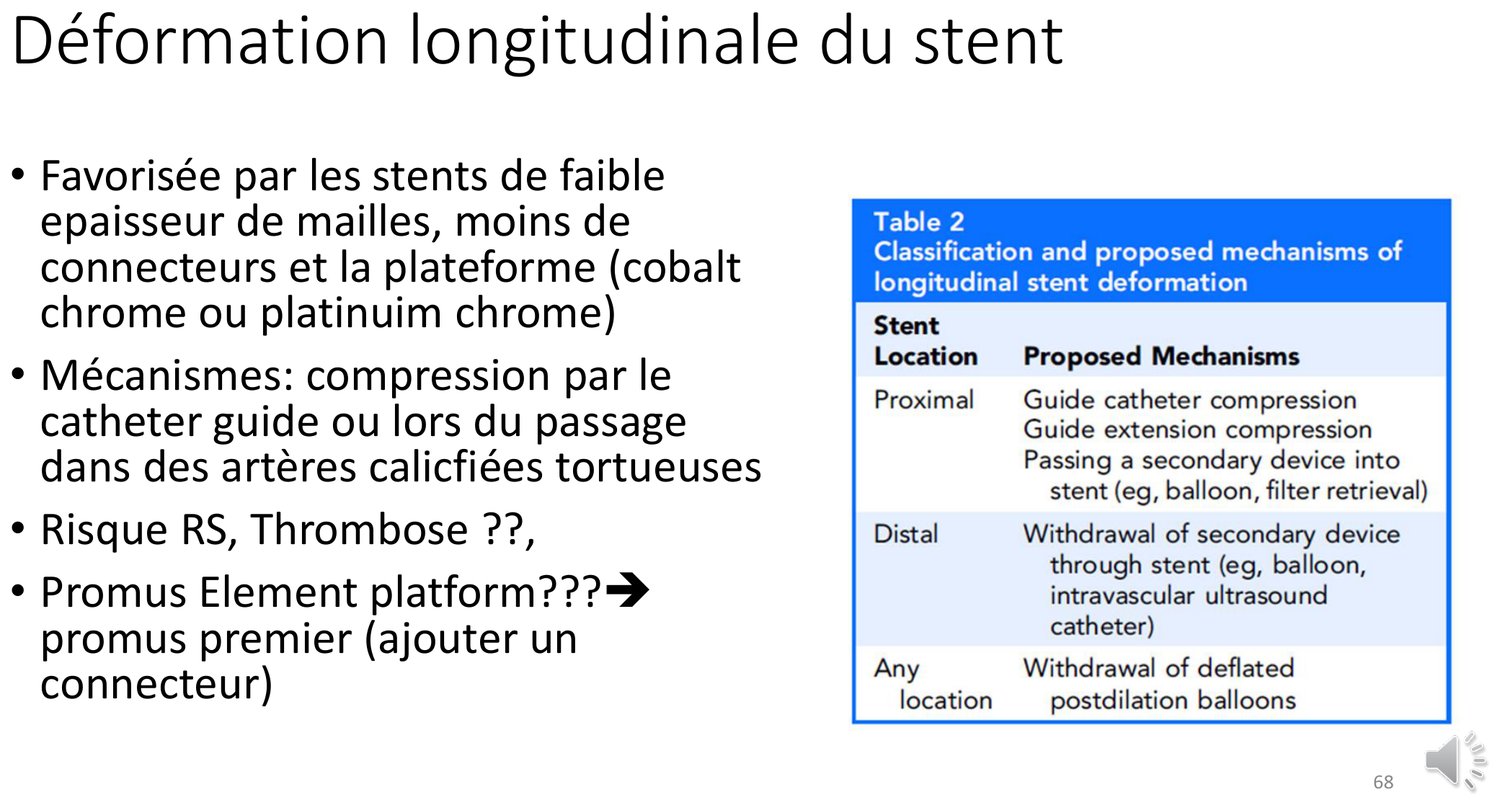 Planche expliquant que la déformation longitudinale est favorisée par les endoprothèses de faible épaisseur de mailles, comportant moins de connecteurs, et par les plateformes en chrome-cobalt ou chrome-platine. Elle en donne les mécanismes et les risques, resténose et thrombose. Un tableau associé classe les mécanismes proposés selon le siège : au niveau proximal, compression par le cathéter guide, compression par une extension, ou passage d'un second dispositif ; au niveau distal, retrait d'un dispositif à travers l'endoprothèse ; à tout niveau, retrait d'un ballon de postdilatation dégonflé mais non replié.