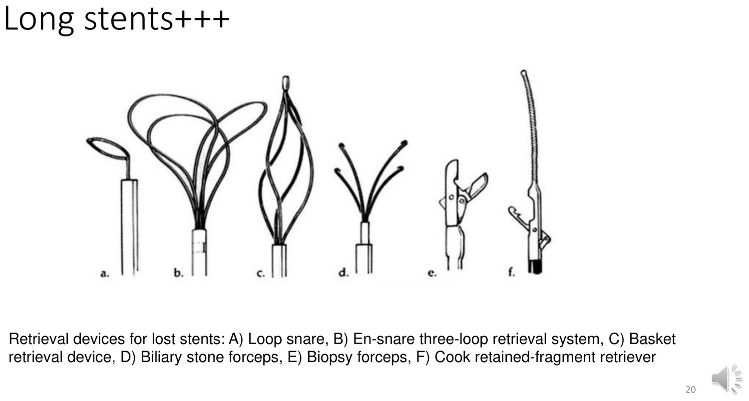 Planche présentant six instruments destinés à récupérer un matériel intracoronaire, repérés de A à F et accompagnés de leurs illustrations : un lasso simple, un système de récupération à trois boucles, un panier de récupération, une pince à calculs biliaires, une pince à biopsie, et un récupérateur de fragment retenu. La légende souligne la diversité des profils et des modes de préhension, chacun convenant à une configuration différente du matériel à saisir.