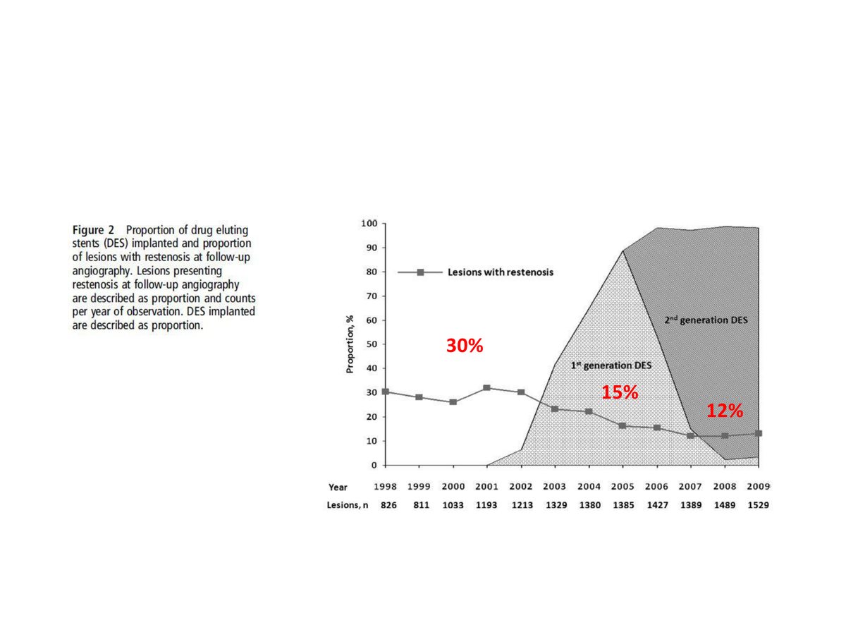 Courbe de la proportion de lésions resténosées de 1998 à 2009 dans une série avec contrôle angiographique systématique, passant de 30 % à 15 % puis 12 % selon la génération d'endoprothèse.