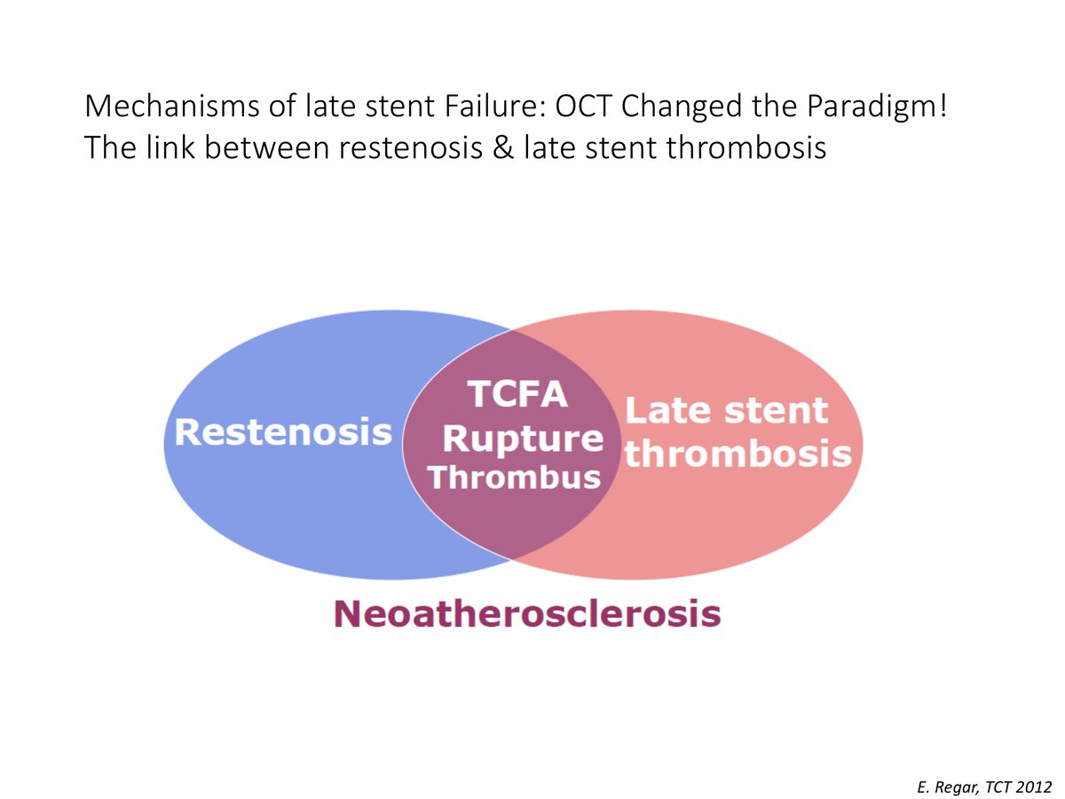 Schéma de deux ensembles se recouvrant, resténose et thrombose tardive d'endoprothèse, dont l'intersection porte la rupture de chape fibreuse et le thrombus, sur fond de néoathérosclérose.