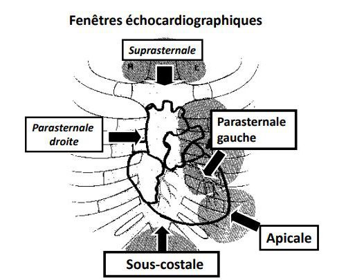 Schéma des fenêtres échocardiographiques sur une silhouette thoracique : suprasternale, parasternale droite et gauche, apicale et sous-costale.