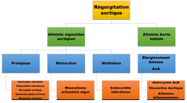 Organigramme reliant la régurgitation aortique à ses deux mécanismes — atteinte des sigmoïdes et atteinte de l'aorte initiale — et aux étiologies associées à chacun.