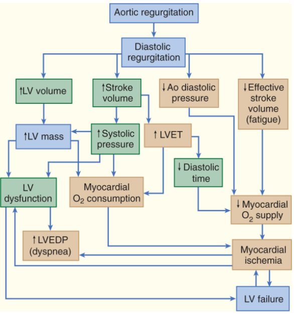 Organigramme en anglais montrant la cascade physiopathologique de la régurgitation aortique chronique, de la surcharge de volume et de pression jusqu'à l'ischémie myocardique et l'insuffisance ventriculaire gauche.