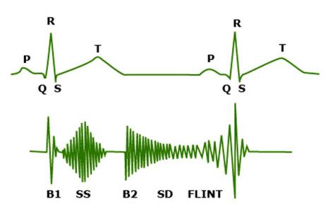 Schéma synchronisant un tracé ECG normal et le phonocardiogramme correspondant, identifiant B1, le souffle systolique, B2, le souffle diastolique et le roulement d'Austin Flint.