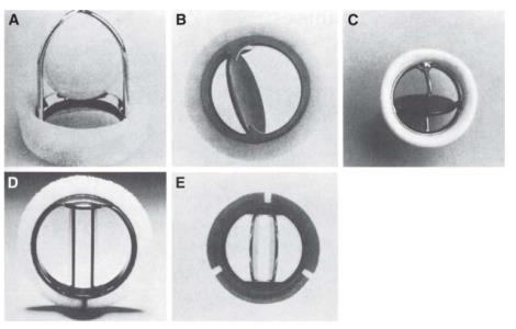 Planche de cinq prothèses valvulaires mécaniques : valve à bille cagée, disque basculant simple vu de profil et de face, et prothèse à double ailette vue de face et en angle.