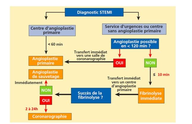 Arbre décisionnel français du STEMI opposant angioplastie primaire et fibrinolyse selon le délai d'accès à la salle de cathétérisme.