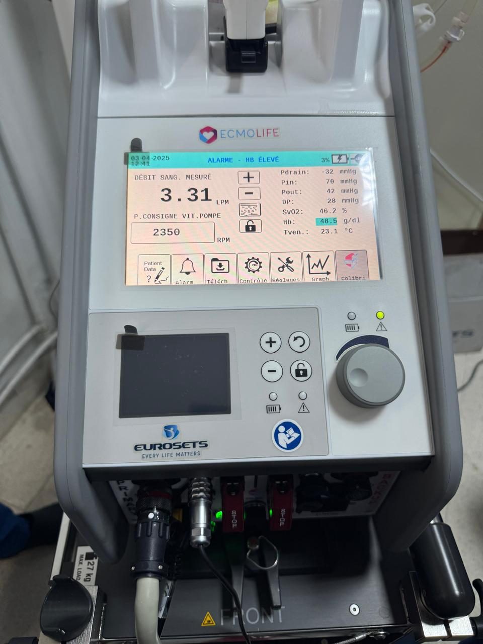 Figure 5 — Console d'une ECMO veino-artérielle en fonctionnement : la machine affiche séparément la vitesse de consigne de la pompe centrifuge (2350 tours/min) et le débit sanguin réellement mesuré (3,31 L/min) — deux grandeurs distinctes —, une pression de drainage négative (−32 mmHg) et une saturation veineuse en oxygène effondrée (46 %) qui traduit le bas débit assisté.