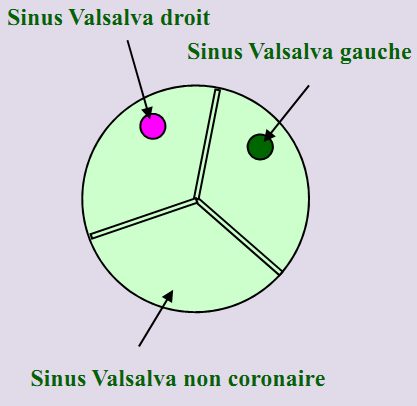 Figure 1 — La valve aortique normale en coupe transversale, référence à laquelle tout se compare : trois sinus de Valsalva, dont deux portent un ostium coronaire, et trois commissures réparties à cent vingt degrés. Retenez la géométrie en Y : c'est elle qui manquera dans une bicuspidie.