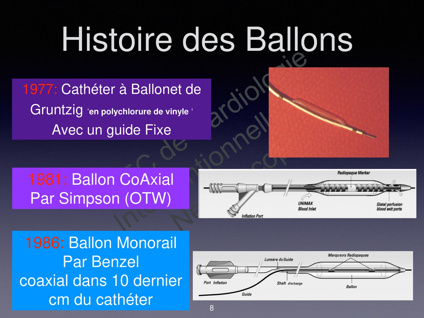 Schéma comparant les architectures à guide fixe, over-the-wire et monorail d'un cathéter à ballonnet.