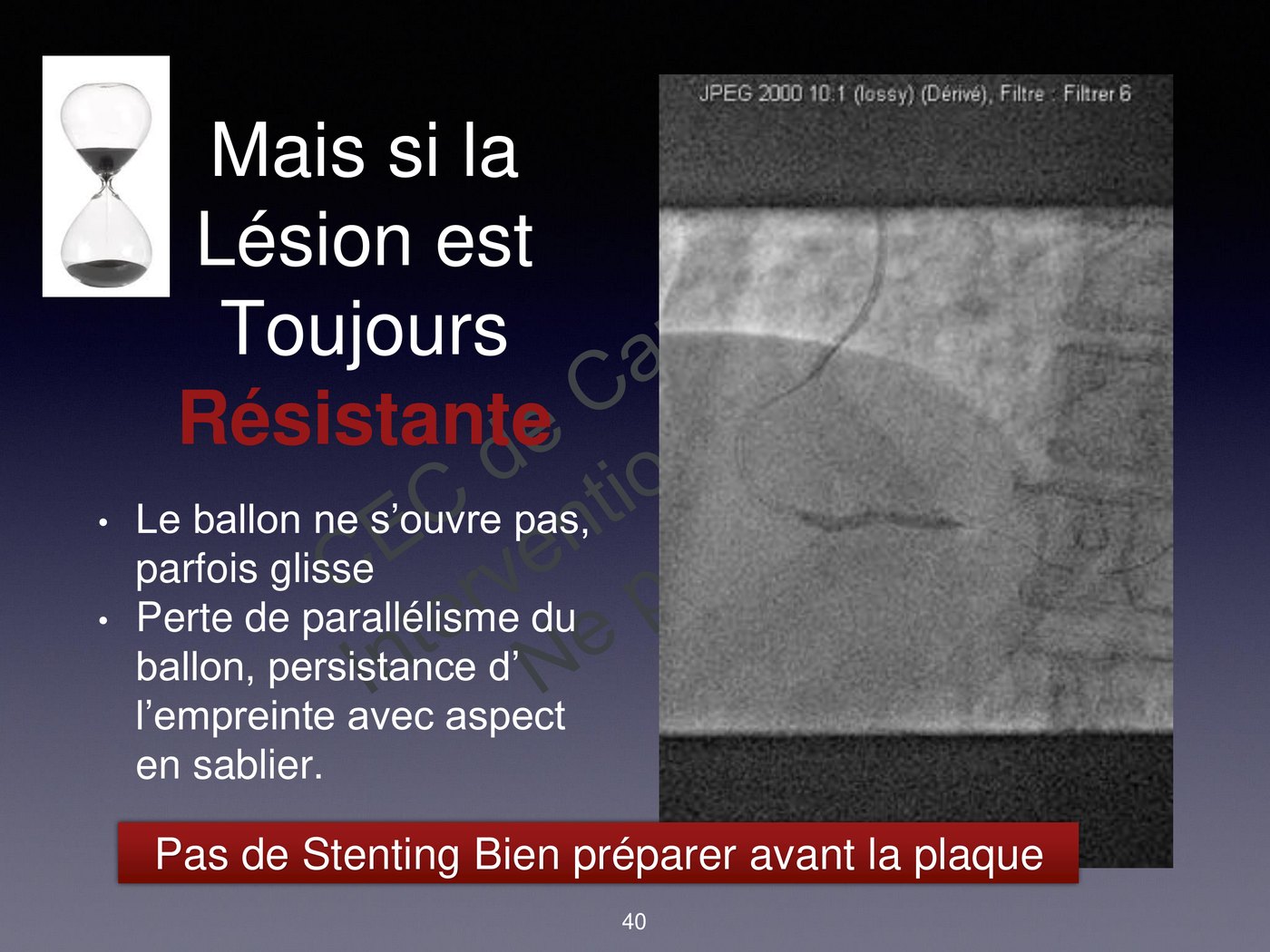 Images de scopie montrant un ballon en sablier et un ballon qui glisse hors de la lésion.