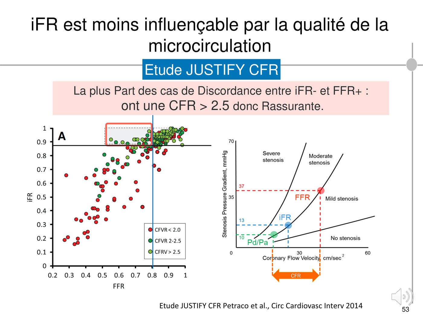 Nuage de points iFR contre FFR coloré selon la réserve coronaire, et courbes reliant le gradient de pression à la vélocité du flux selon la sévérité de la sténose.