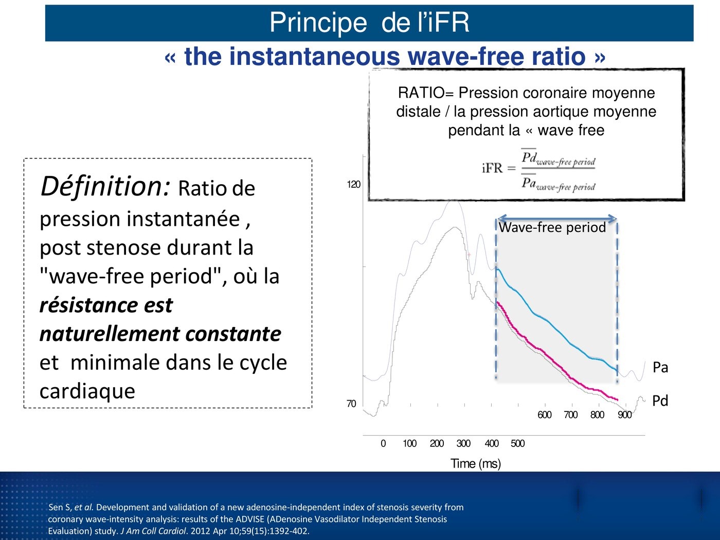 Tracés simultanés de pression aortique et de pression distale sur un cycle cardiaque, avec la période sans onde grisée et la formule de l'iFR.