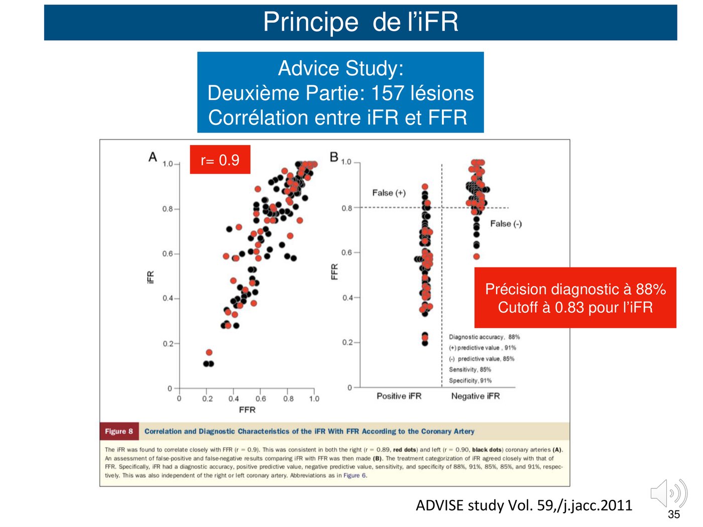 Nuage de points corrélant iFR et FFR sur 157 lésions, et répartition des valeurs selon le classement positif ou négatif de l'iFR.