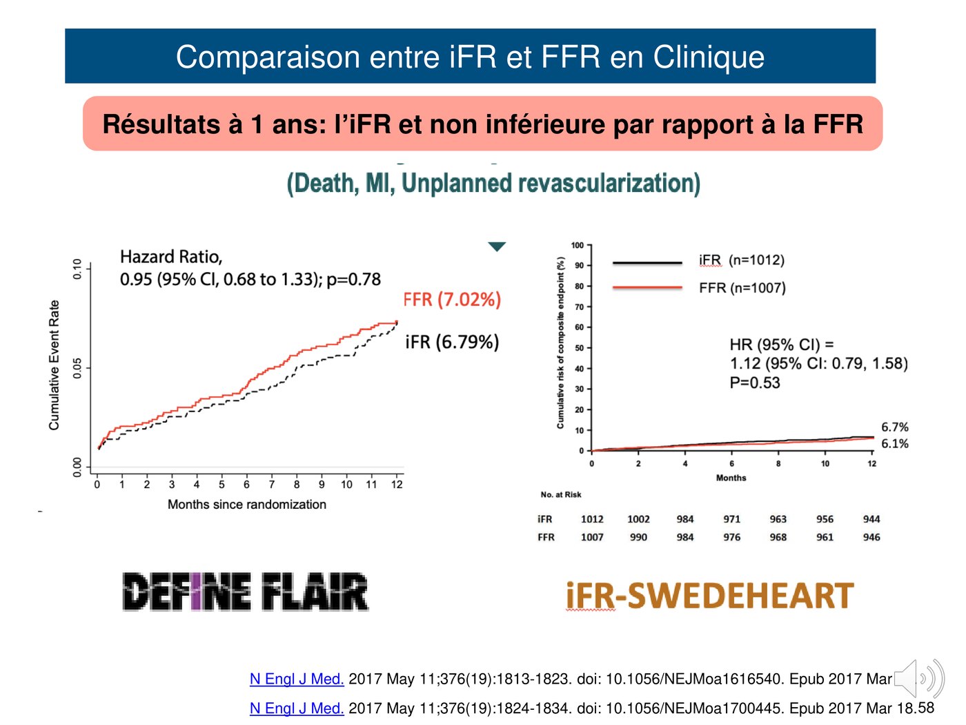 Courbes d'incidence cumulée du critère composite à un an dans les deux essais randomisés comparant l'iFR et la FFR.