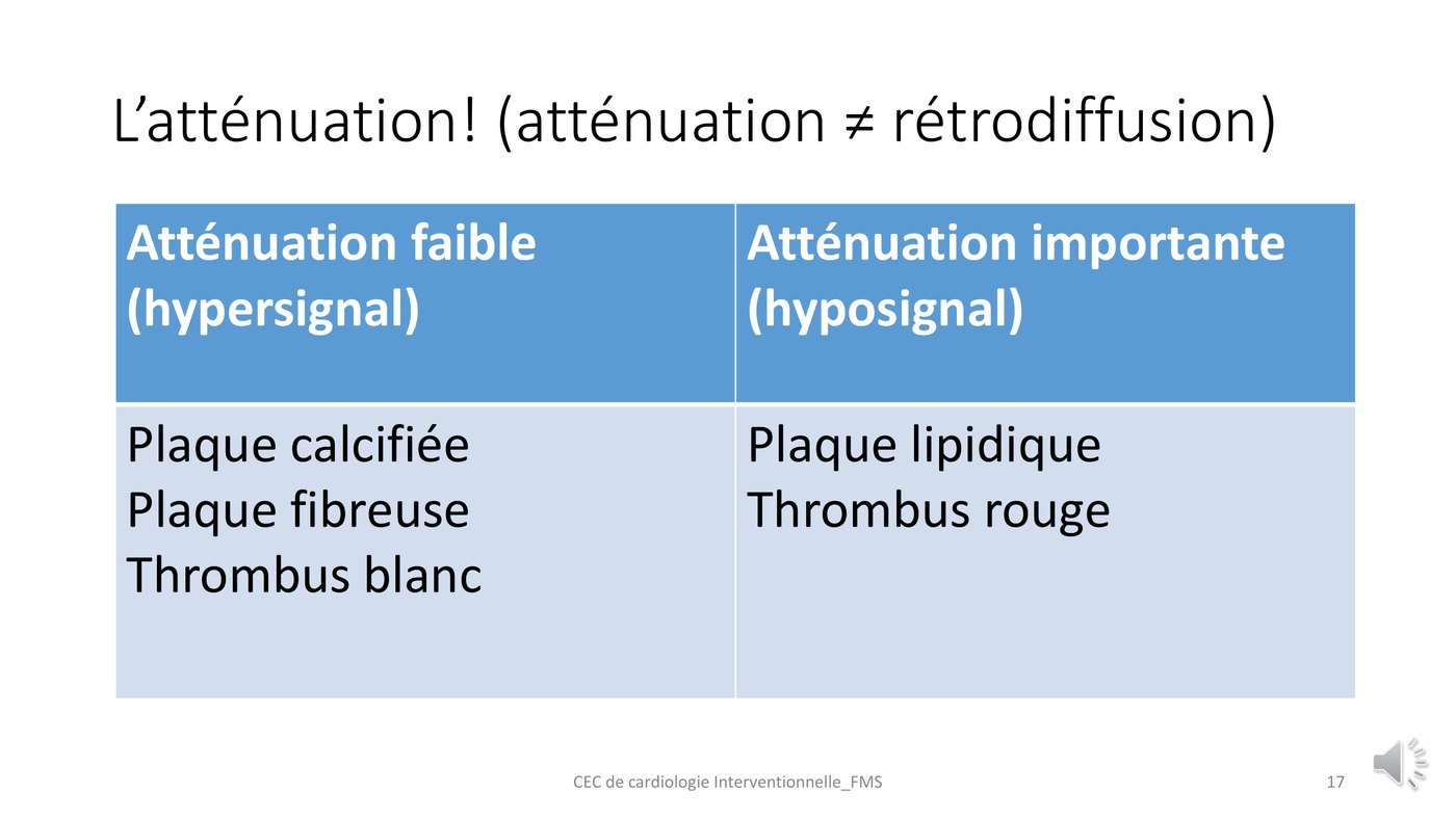 Tableau classant les tissus coronaires selon une atténuation faible ou importante du signal en tomographie par cohérence optique.