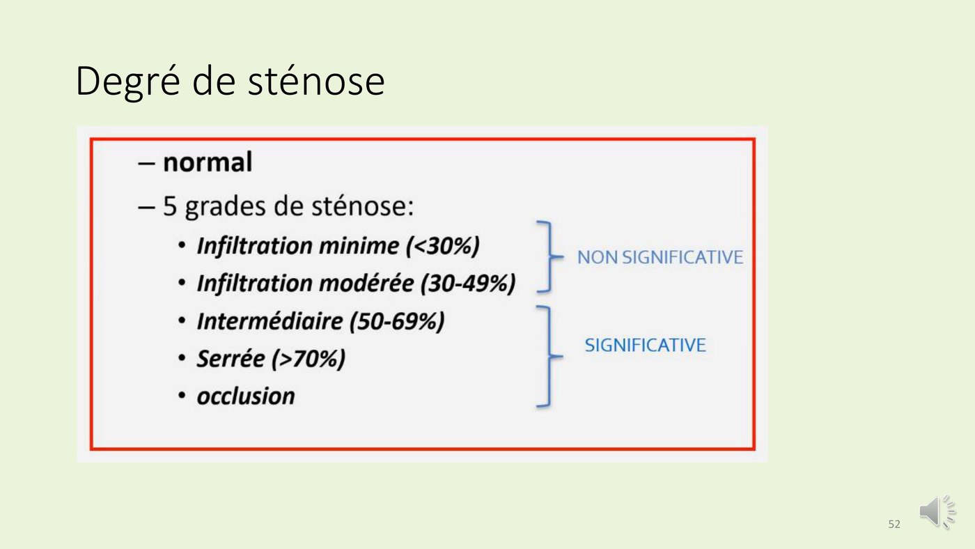 Tableau des cinq grades de sténose coronaire au scanner, du minime à l'occlusion, avec le seuil de significativité à 50 %.